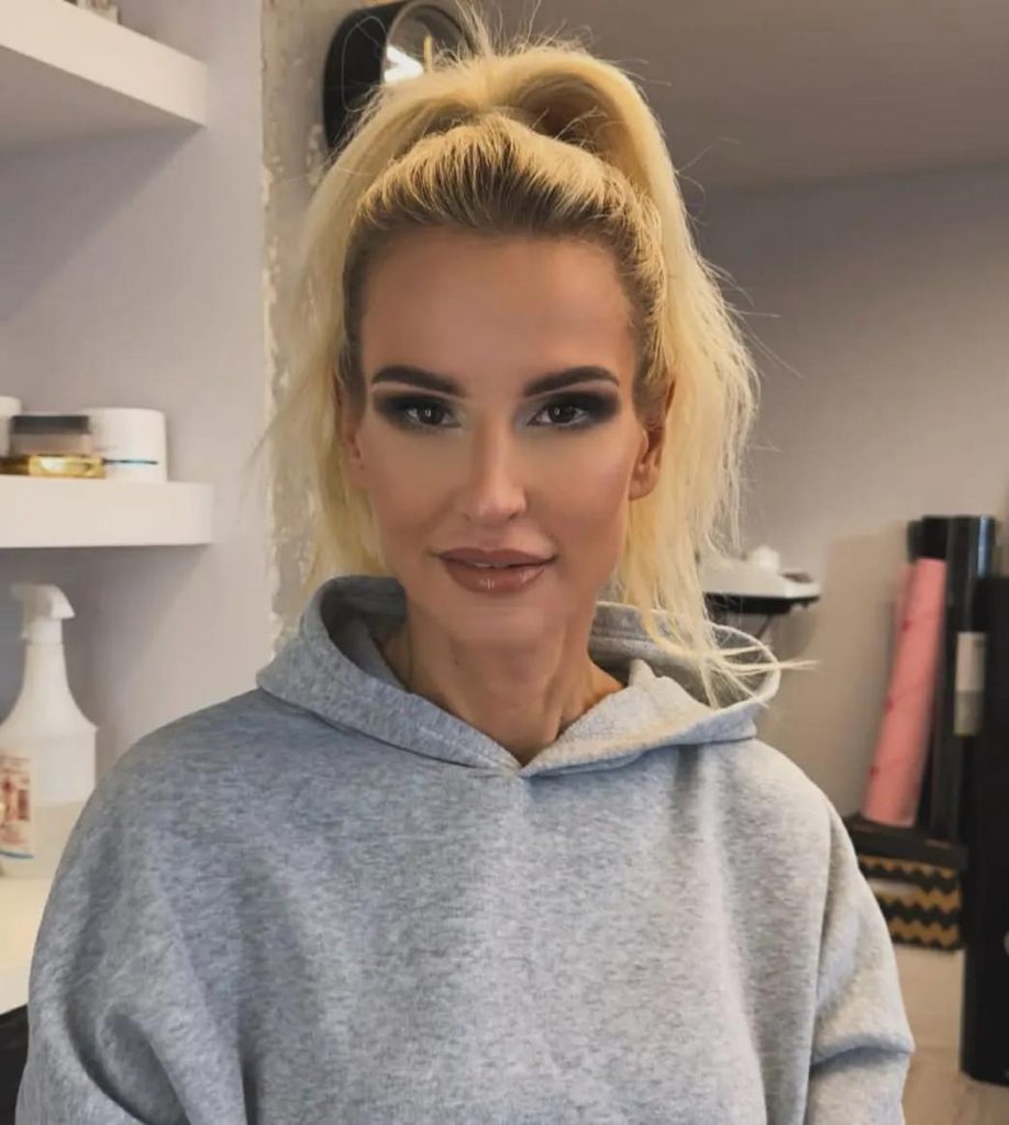 Dominika Tajner po abdominoplastyce - jak wygląda brzuch po 3 miesiącach i kiedy widać ostateczny efekt
